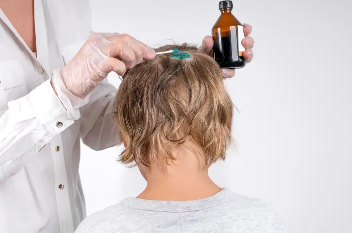 Effective Natural Remedies to Treat Children's Head Lice